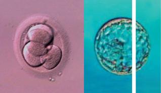 Benachteiligt die Schweizer Gesetzgebung unsere Patientinnen?