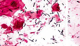 Von der Koagulation zur Versiegelung der Gefässe