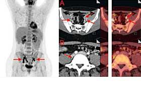 Ein Leuchten am Horizont?