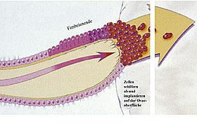 Ethische Aspekte in Gynäkologie und Geburtshilfe