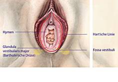 Schmerzhafte Vulva: Vulvodynie, Vestibulitis