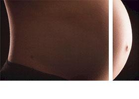 Mammakarzinom und Schwangerschaft