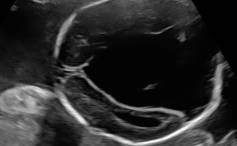 Sonoquiz 04/18 – Was ist das?