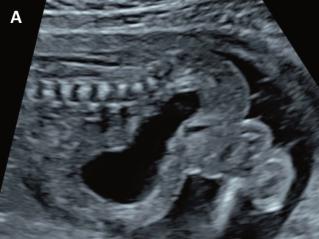 Sonoquiz – Was ist das?