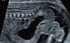 Sonoquiz – Was ist das?