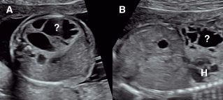 Sonoquiz – Was ist das?