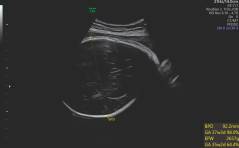 Sonoquiz - Was ist das?