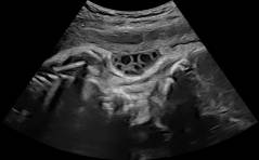 Sonoquiz - Wo liegt die Auffälligkeit?