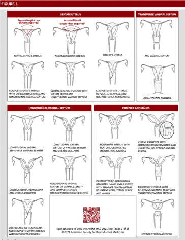 Abb. 1. ASRM-2021-Klassifizierung der Müllerschen Fehlbildungen