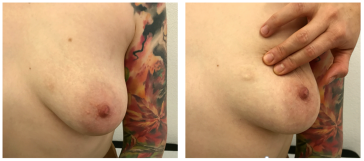 Abb. 1. Klinischer Befund