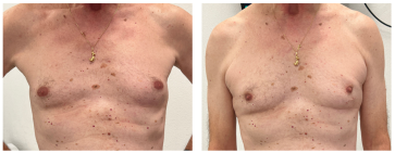 Abb. 9. Prä- und postoperativer Status