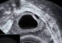 Gemeinsam auf dem Weg zur Familienplanung: Diagnostik in Frauenarztpraxis und Kinderwunschzentrum