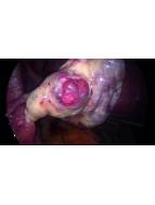 Frauenheilkunde aktuell 01/2023