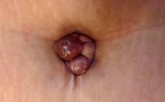 Auflösung Pathoquiz