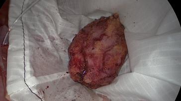 Abb. 5. Entfernung im Bergebeutel