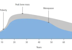 Leiden vermeiden – was man in der frauenärztlichen Praxis über Osteoprotektion wissen sollte