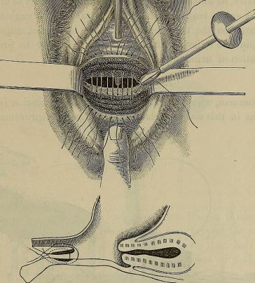 Aus: Wikimedia; Reproduktion erlaubt