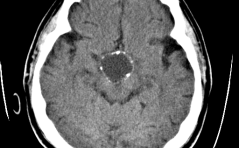 Fortpflanzungsmedizin up to date