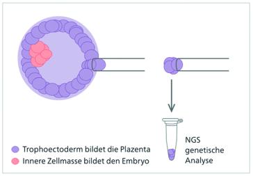 Abb. 1. Trophektoderm Biopsie am 5. Tag. Diese Zellen bilden die Plazenta. Quelle: https://www.viollier.ch/sites/default/files/documents/2023-05/FRA_D_PGT-A_Consent.pdf