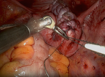 Abb. 5. Zum Ende der Rekonstruktion.