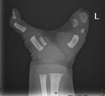 Abb. 2. Handröntgen