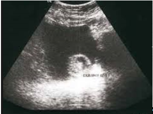 Abb. 1. Transabdominaler Ultraschall