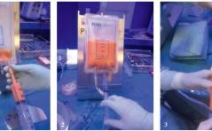 Senologie up to date