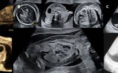 Sonoquiz: Was ist Das?