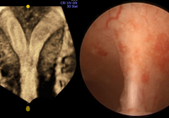 Die praktische Bedeutung der Müllerschen Fehlbildungen