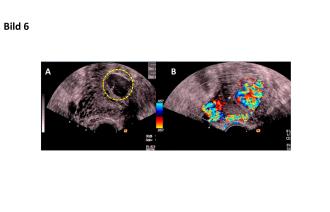 Abb. 6