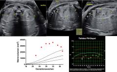 Sonoquiz - Auflösung aus Ausgabe 03/19