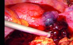 Der spezielle Fall - Mehr als eine Tubagravidität