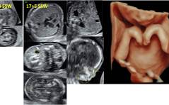 Sonoquiz - Was ist das?